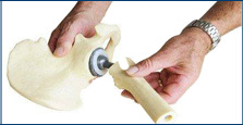medical welding