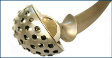 laser welding